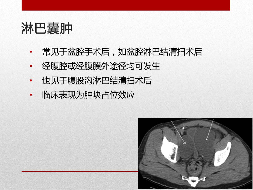 泌尿外科腹腔镜手术适应症,泌尿外科腹腔镜并发症