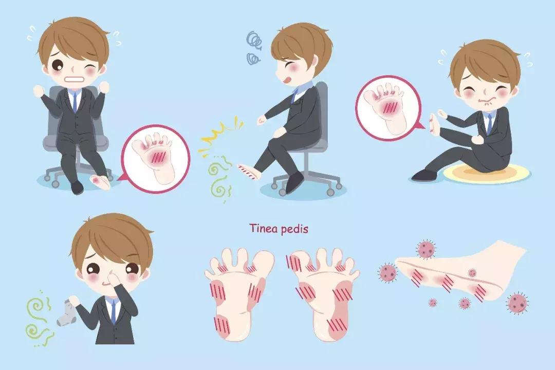 脚气犯了怎么办,脚气用错药导致红肿怎么办