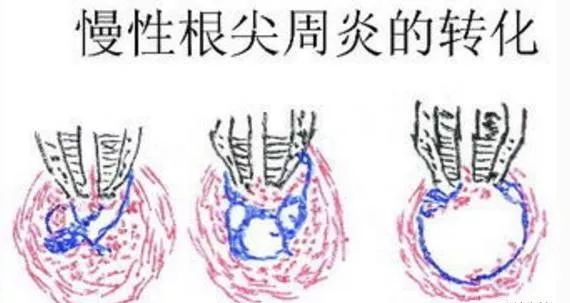 牙疼不是病痛起来要人命图片,牙疼不是病疼得要人命