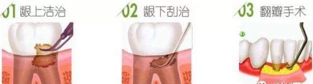 牙疼不是病痛起来要人命图片,牙疼不是病疼得要人命