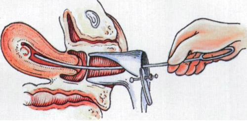 子宫受伤有哪些症状和危害,子宫受到打击会怎么样