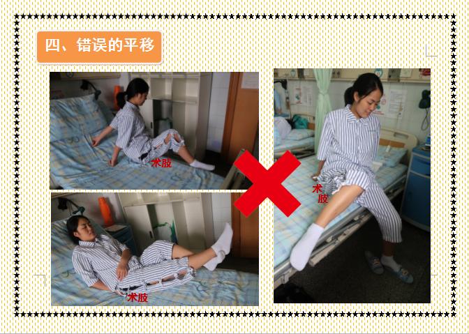 人工髋关节置换术前准备护理,人工髋关节置换术的健康宣教手册