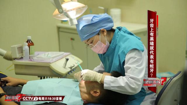 大板牙有黑缝是蛀牙吗,板牙黑缝是蛀牙吗