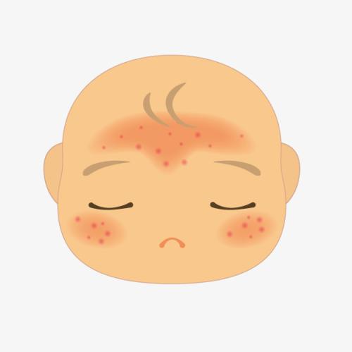 为什么新生儿脸上会有小疹子,为什么新生儿脸上长小红点