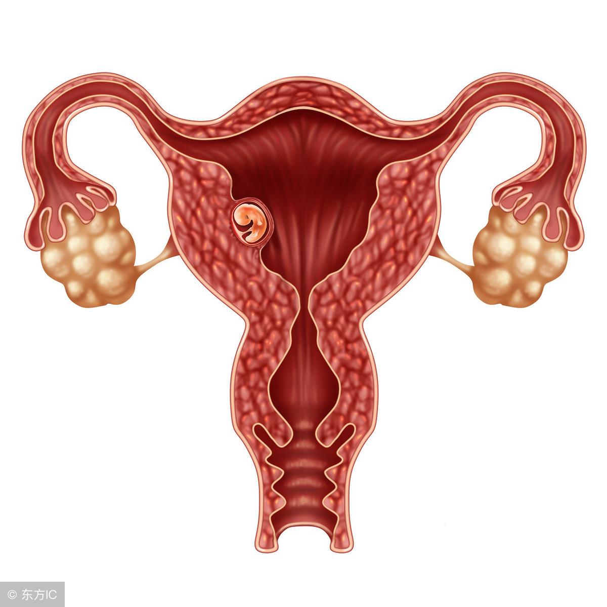 宫颈糜烂的出现到底是清洁不到位还是另有原因呢