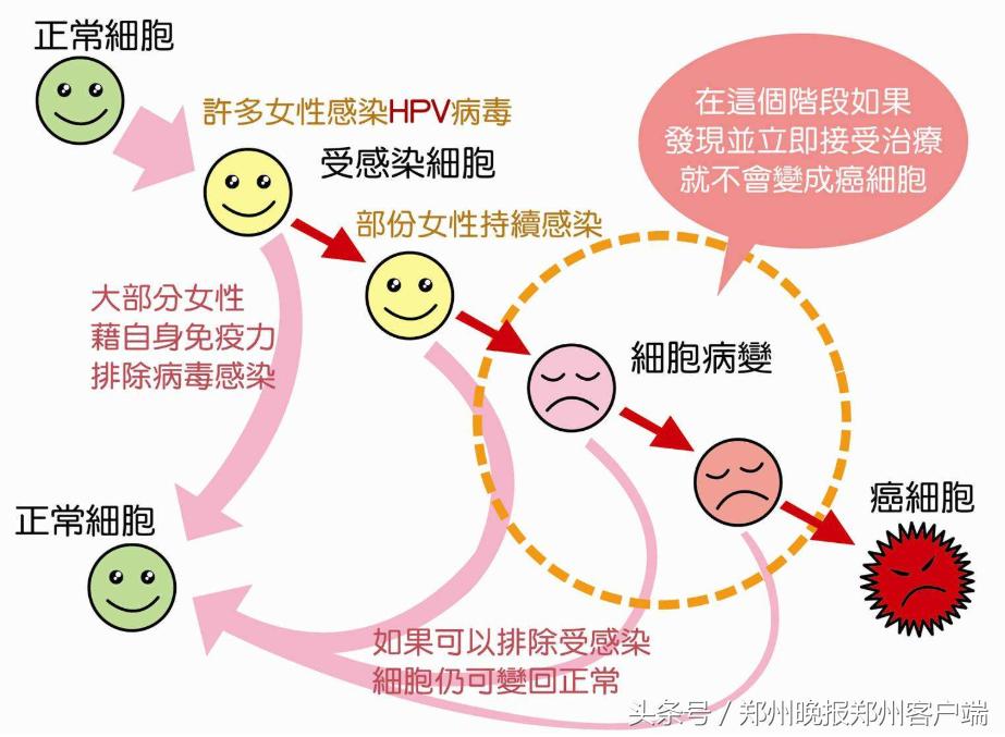 河南可以打九价宫颈癌疫苗的地方,河南哪里可以打宫颈癌疫苗四价
