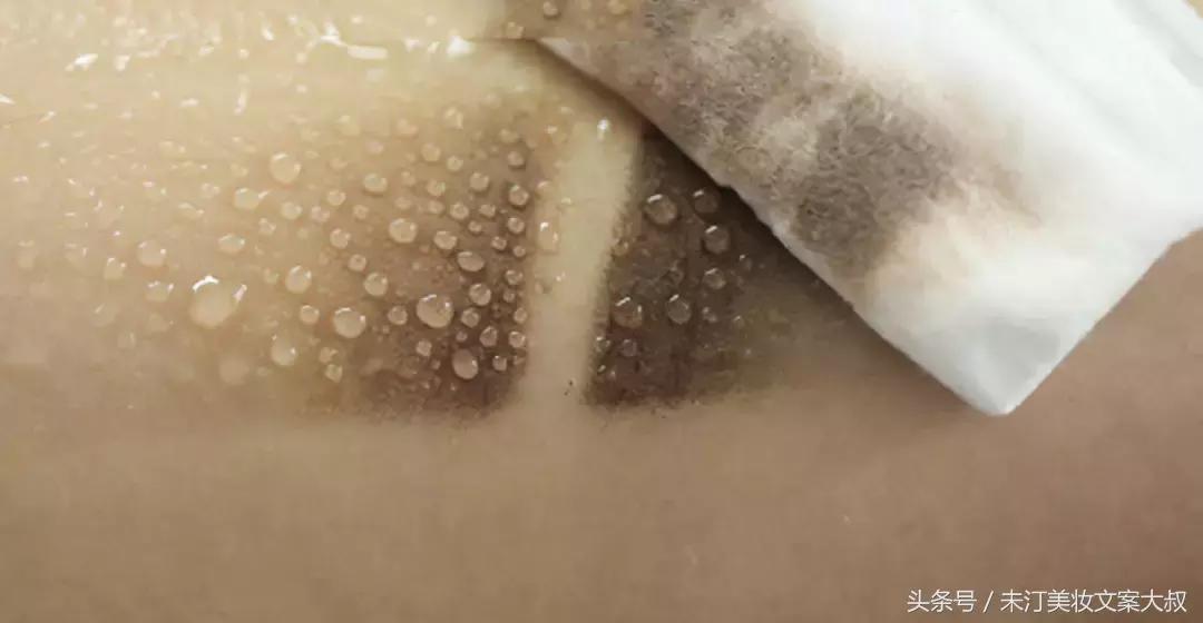 浣犺繕鍦ㄤ负浜嗚劚鍙戠儲鎭煎悧,浣犺繕鍦ㄤ负浣犺劚鍙戠儲鎭艰嚜鍗戝悧