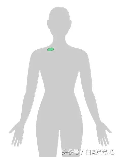 李咏是因为癌症死亡的吗,李咏得的啥癌症为什么葬在美国