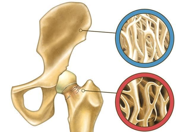 老人手关节疼痛警惕四种病,老人手脚关节痛浮肿是什么原因