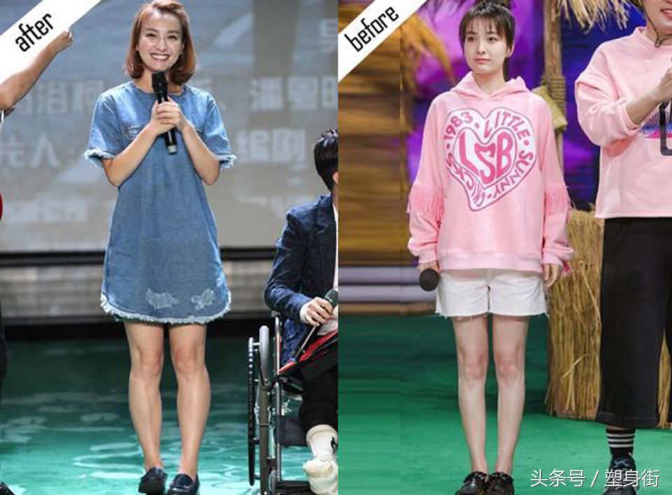 腿不直怎么矫正腿型吴昕,改善腿型让腿变直神器吴昕