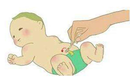 宝宝肚脐眼疝气怎么办,宝宝脐疝和正常肚脐的图片