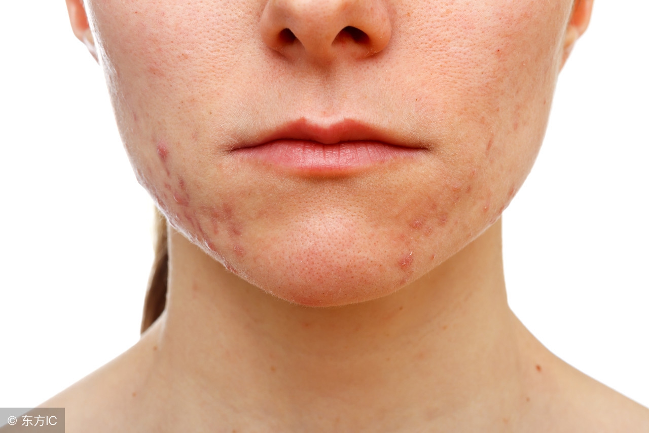 去妊娠纹修复测评推荐,去妊娠纹产后修复排行榜