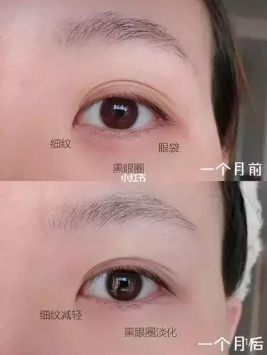 怎么挑选一款适合的眼霜,怎么选择一款适合自己的眼霜