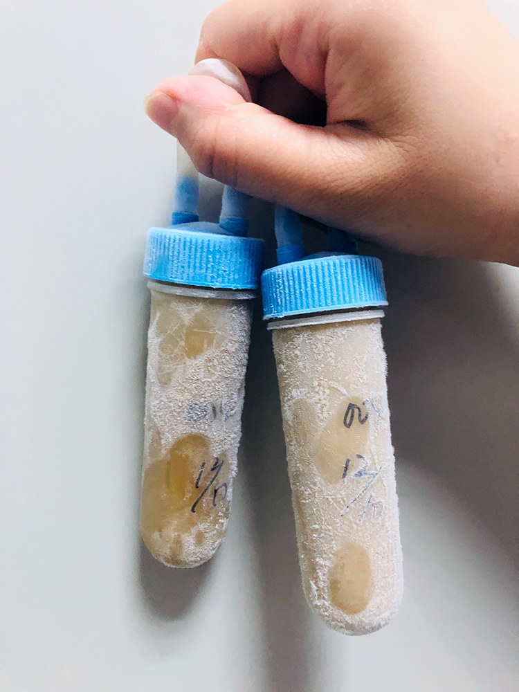 屎是不是可以治病,粪便可以治病嘛