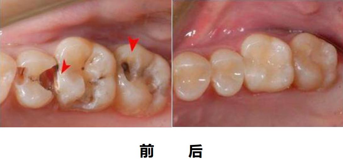 关于开口腔门诊的知识,带您一分钟了解诊所