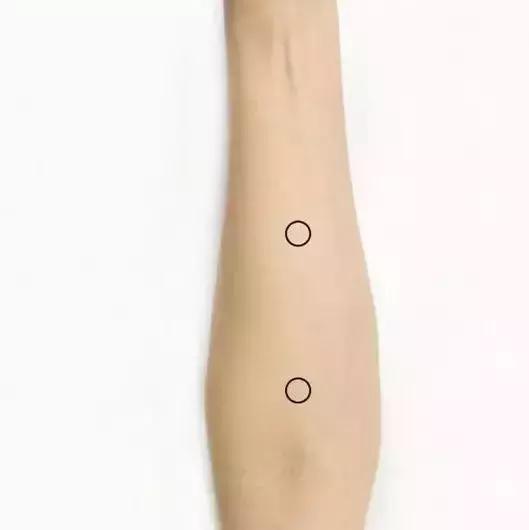 胡希恕经方治疗乳腺增生,中医治疗乳腺增生的处方