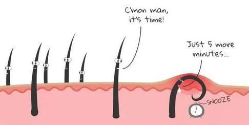 脱毛用什么产品比较好,如何选择脱毛产品