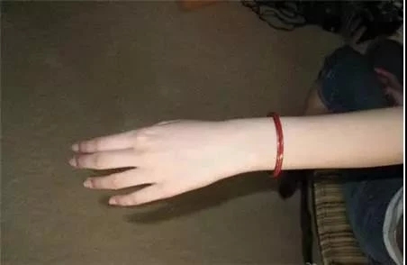 手镯手胖了取不下来有妙招,手镯戴起不舒服怎么回事