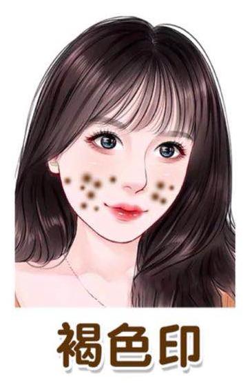 祛脸上痘印公认最好的方法,如何祛脸上的痘印学生党