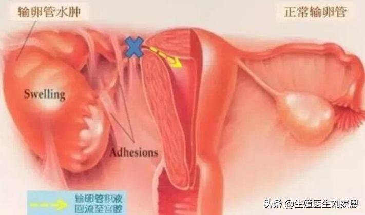 做宫腹腔镜有什么禁忌和损害,宫腹腔镜可以查到哪些问题