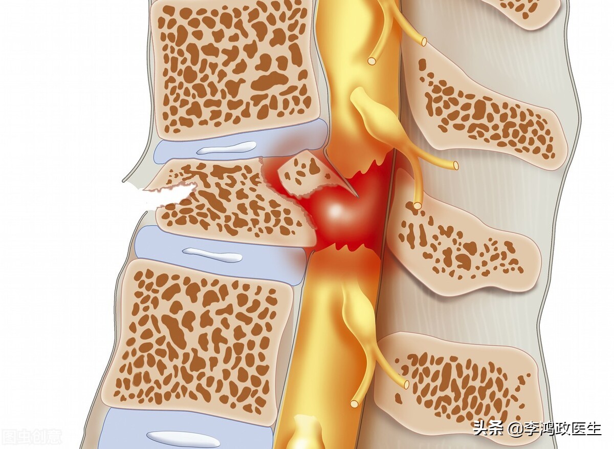 男性贫血需要住院吗,自身免疫性贫血需要不定期输血