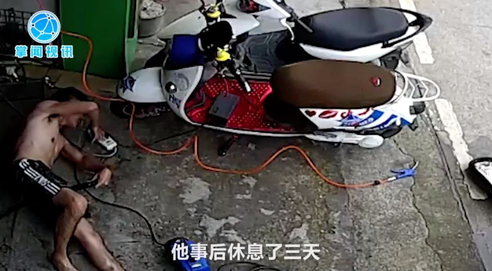 触电人神志清醒时救护方法步骤,触电后几分钟抢救最好