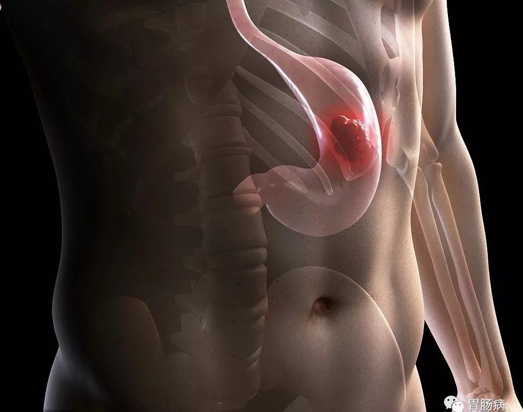 做胃镜怎样配合医生才不感觉痛苦,做胃镜的医生说不严重靠谱吗