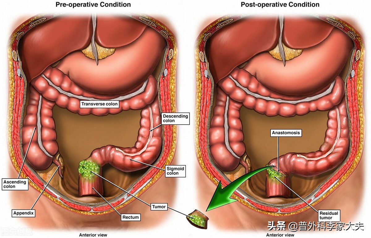 肛门和直肠疼痛是什么症状,肛门直肠痛的症状有哪些