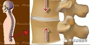 72岁老人腰疼还有骨刺该怎么治疗,老年人骨刺疼痛怎么治疗