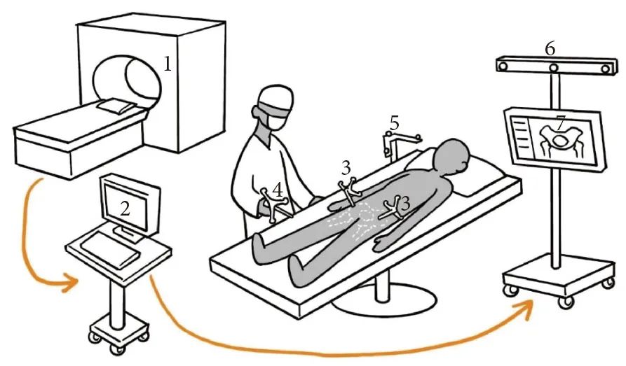 骨盆骨折复位只能凭经验＋透视？这项技术可能会颠覆你的认知