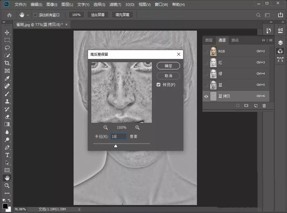 祛除脸部雀斑最有效的方法,有什么日常方法可以去除脸上雀斑