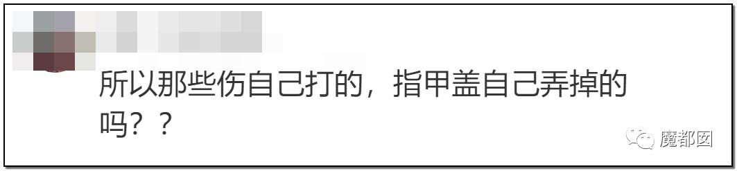 短跑名将张培萌被曝家暴,短跑名将张培萌殴打岳母被行拘