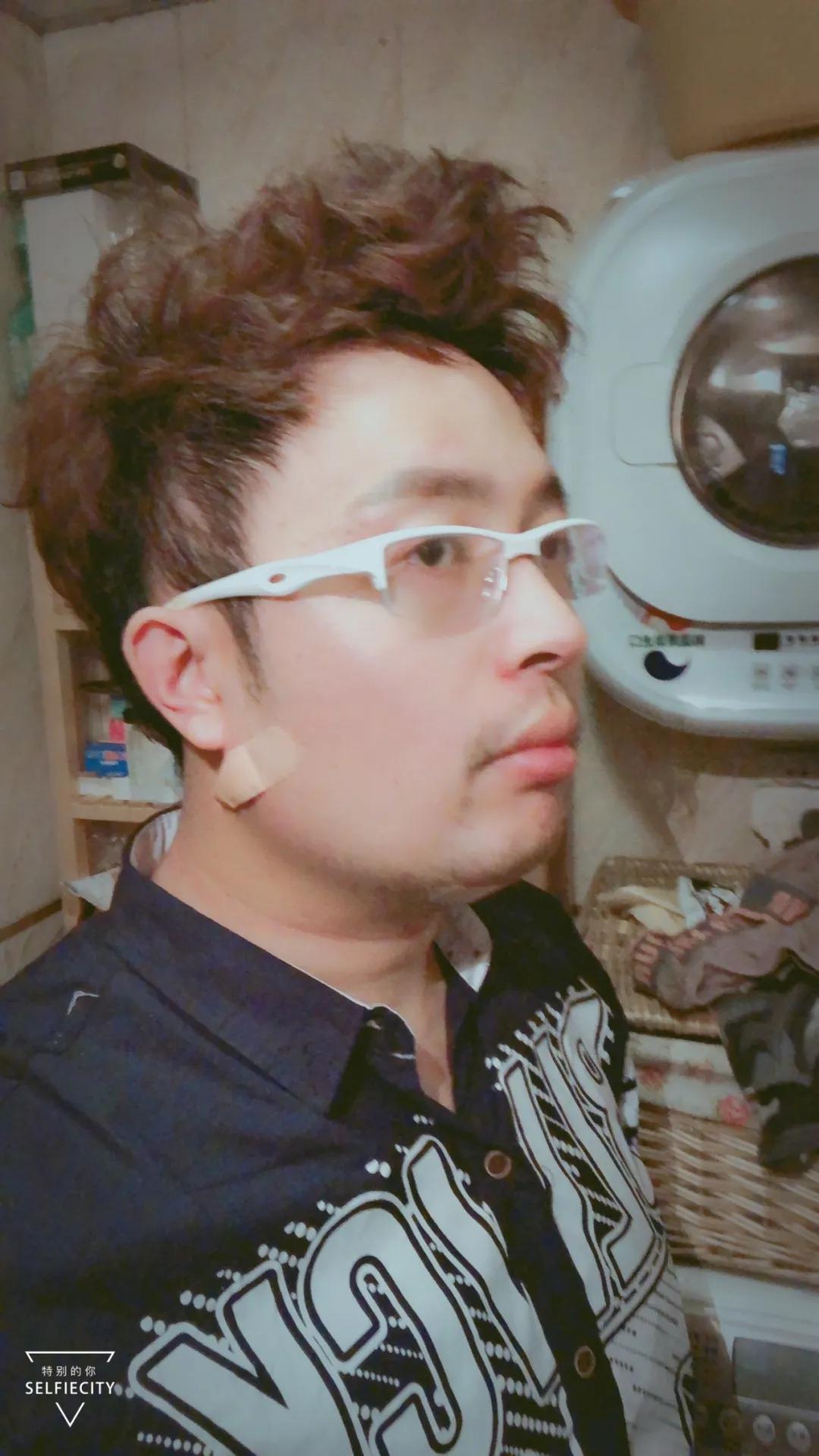 抽脂亲身经历回忆,抽脂血泪史