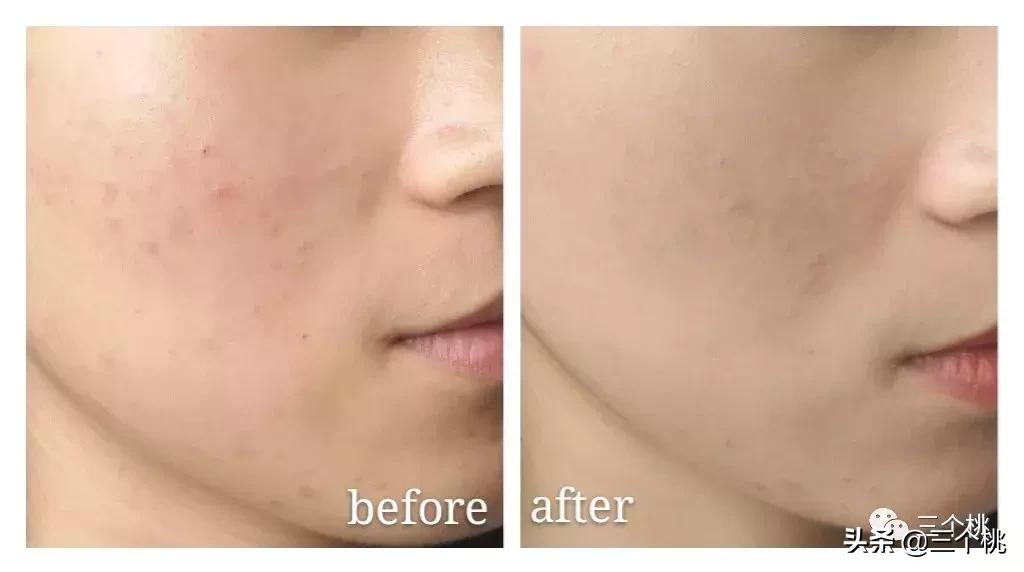 口碑最好十大粉底液夏季,十大公认好用的粉底液及价格