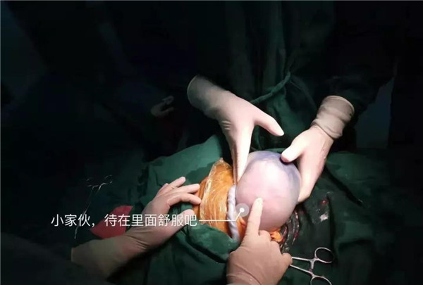 36周产下男婴肚子里还有哪吒,哪吒怀孕42周