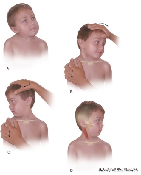 宝宝老是歪头后仰头,宝宝歪脖歪头怎么办