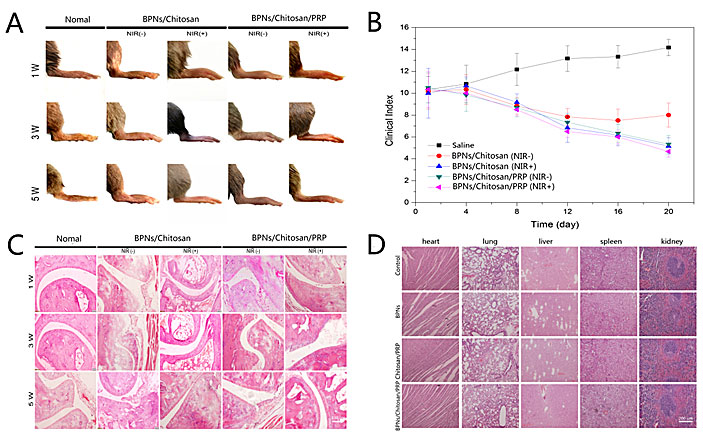 基于黑磷纳米片的多功能温敏水凝胶系统治疗类风湿