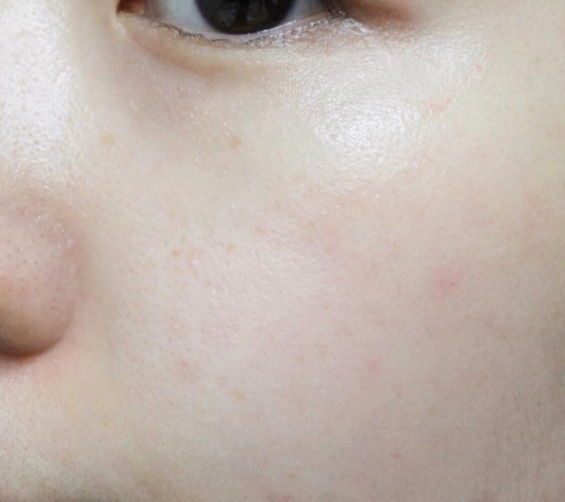 温和不刺激敏感肌可用的补水面膜,使用过后不油腻的面膜