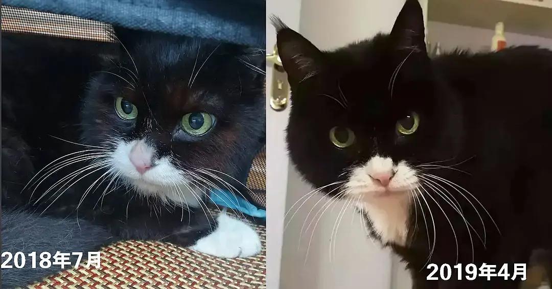 糖尿病患者胆囊炎胰腺炎同时出现,胆囊结石胰腺炎糖尿病