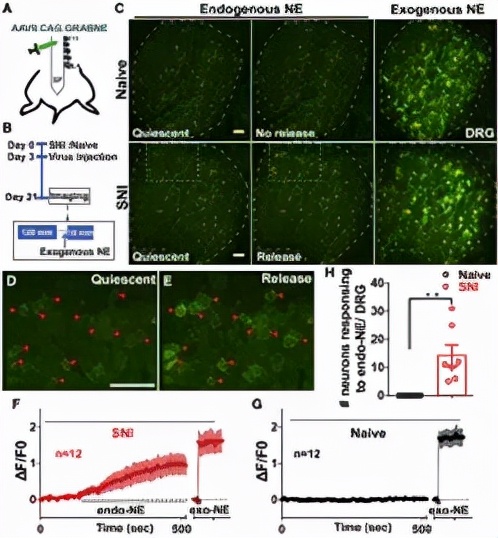 Neuron：董欣中/张俊明合作揭示神经损伤后自发性疼痛产生新机制