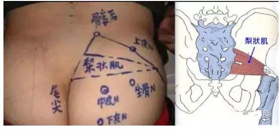 久坐整个臀部不舒服,夏天久坐者屁股又痛又破皮怎么办