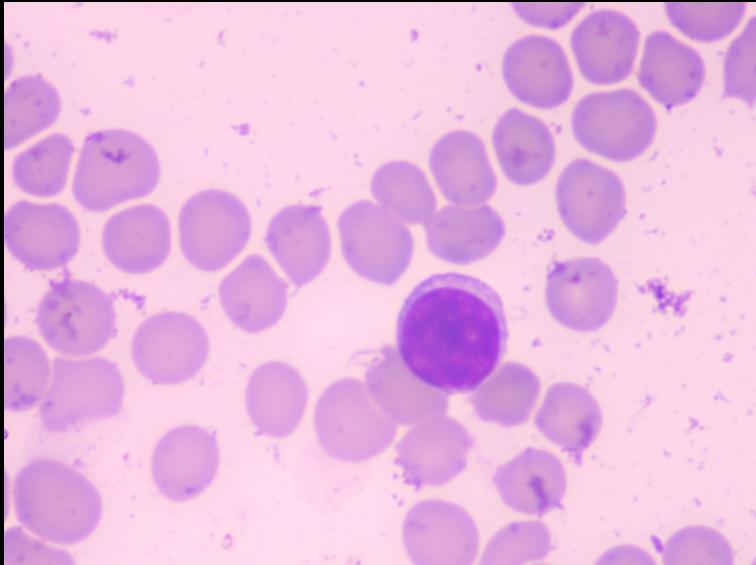 猫咪爪垫红肿怎么办,猫咪的爪垫会蜕皮吗