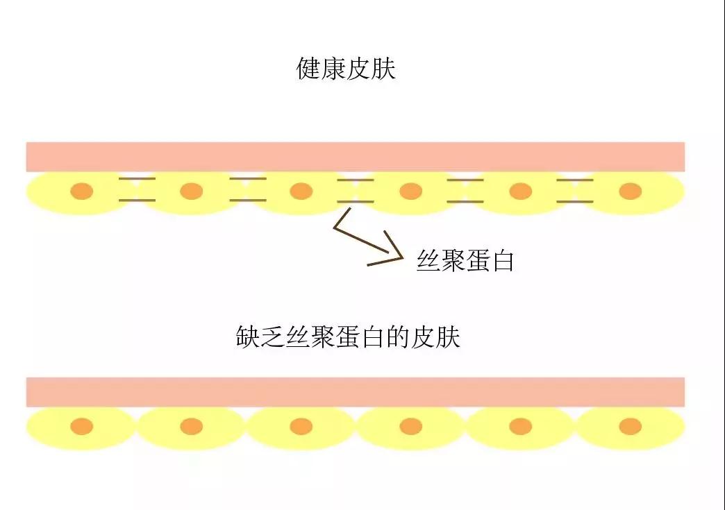 宝宝身上红点点是湿疹么,宝宝起湿疹和热痱子怎么区分