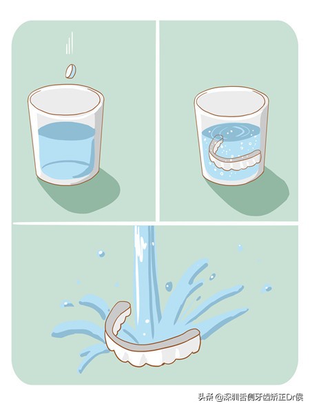 保持器怎么做微调,保持器该怎么选