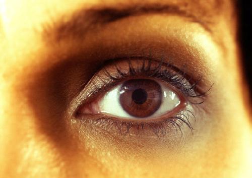 黑眼圈形成的原因有哪些,黑眼圈的形成原因与治疗方法