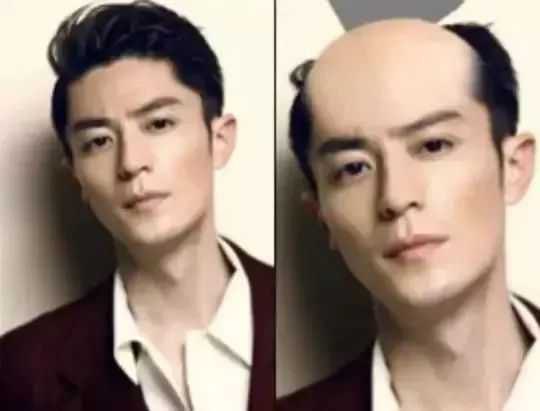 有了这个神器，英国人的脱发有救了？