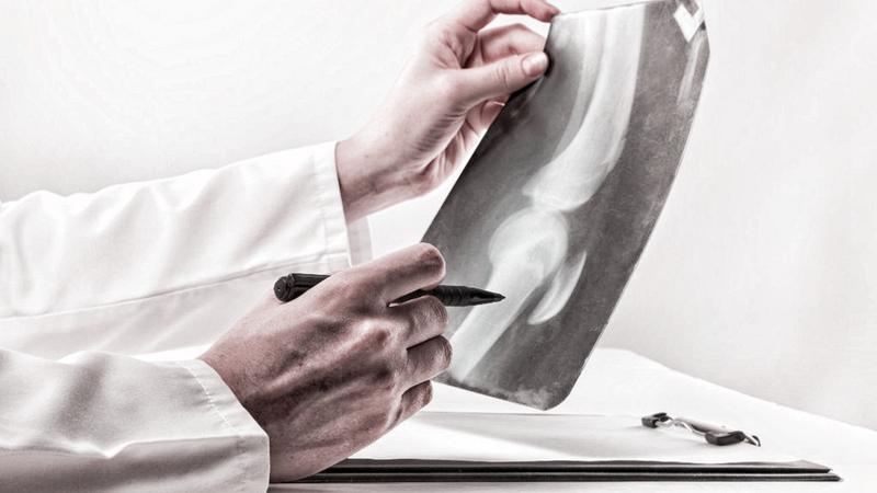 内侧半月板后角损伤三度能恢复吗,老年人半月板三度损伤还能恢复吗