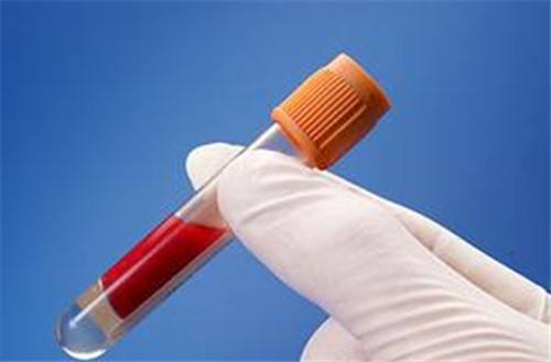 早孕检查是抽血好还是做b超好,早孕期检查都正常但还是出血