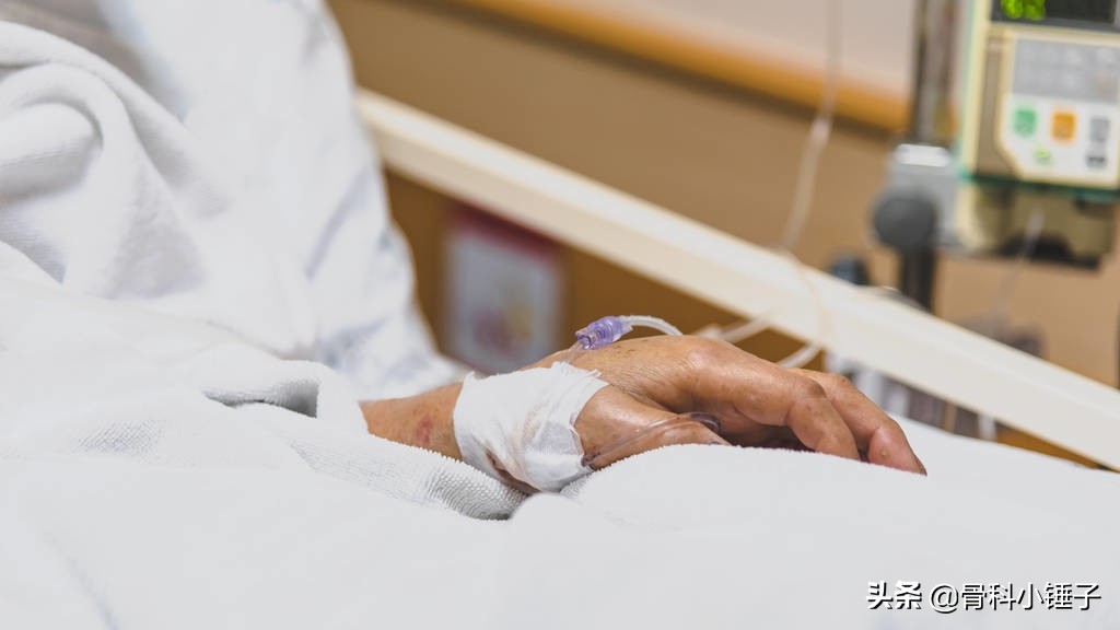 80岁老人胯骨摔骨折怎么恢复,85岁老人胯摔骨折了需不需要手术