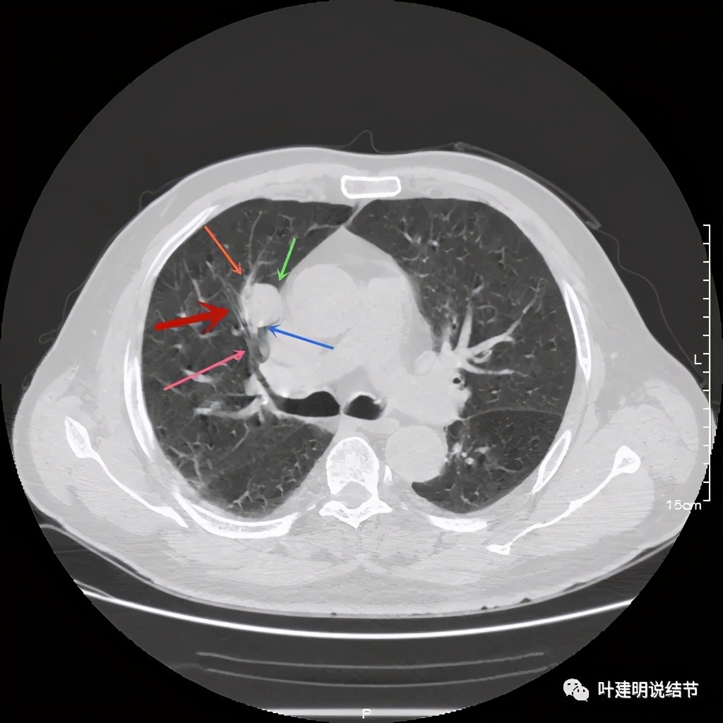 误诊报告图片,误诊案例及案例分析